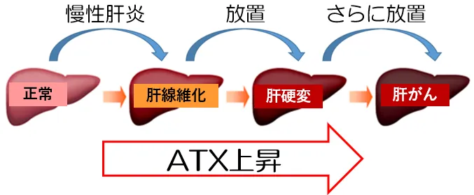 plus_atx.webp