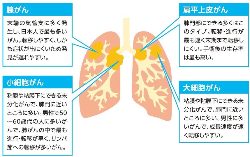 ドック胸部X線検査_表.jpg