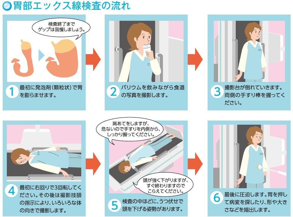胃部X線検査｜人間ドック｜新潟ウェルネス
