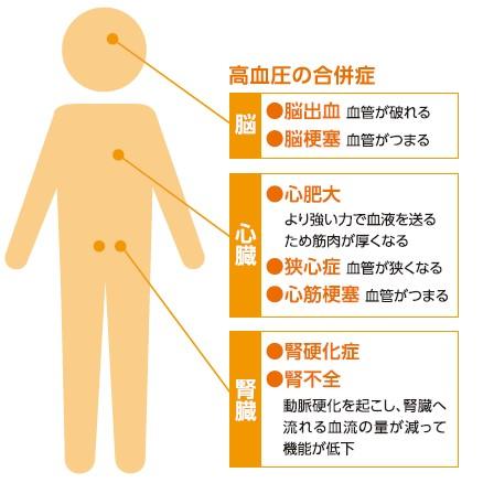 血圧測定｜人間ドック｜新潟ウェルネス