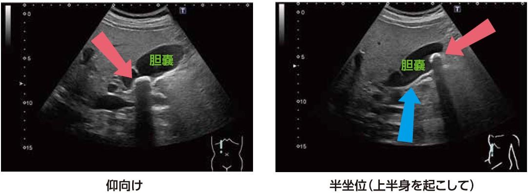 Dr.森の腹部超音波診断パーフェクト Dr.森の腹部超音波診断パーフェクト
