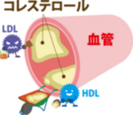 脂質異常を改善する食事のポイント